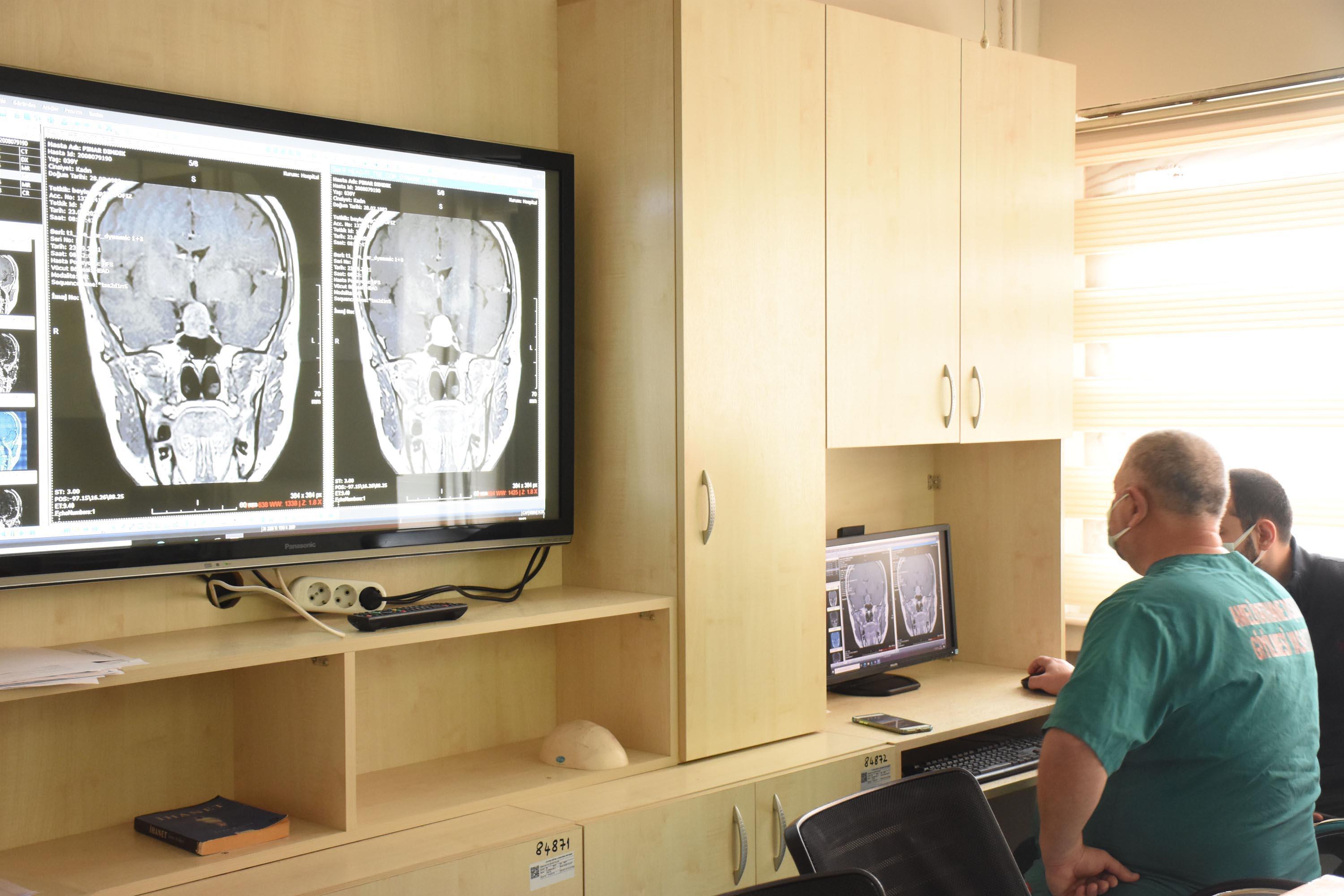 Beyin tümörü bulunan hastaya burundan girilerek interaktif ameliyat