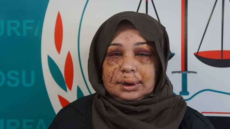 Polis eşi tarafından darbedildiği iddiasıyla şikayetçi oldu