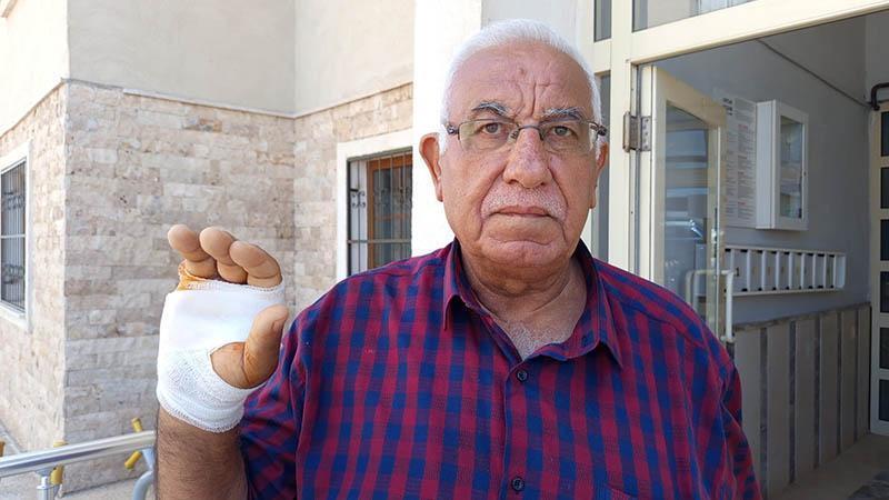 Komşusunun ısırdığı parmağı ampute edildi