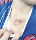 İstanbul - Eyüpsultan'da 3 yaşındaki çocuğa şiddet iddiası