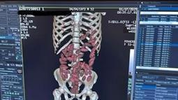 İstanbul- 2025’te İstanbul Havalimanı’nda ‘yutucu’ kuryelerden 29,7 kilo uyuşturucu ele geçirildi