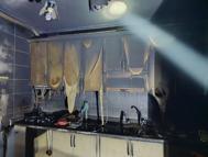 Adıyaman'da ev yangınında ağır yaralandı