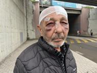 Önce çakmak istediler ardından sokak ortasında darbettiler