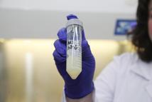 Arı sütü, diyabet hastalarına umut olacak