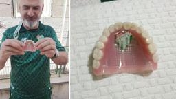 Bursaspor’un fanatik taraftarı takma dişinin damağına da kulüp amblemi yaptırdı