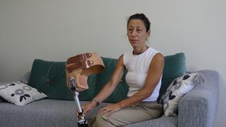 22 yıldır kullandığı protez bacağı ömrünü tamamladı, yenisinin maliyeti 2 milyon TL