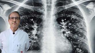 Prof. Dr. Şener'den 'süperenfeksiyon' uyarısı: Dikkat etmek lazım, ücretsiz aşınızı olun