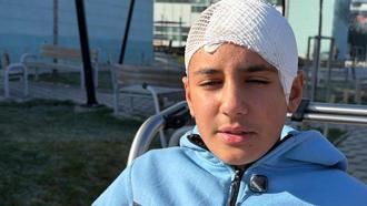 Şakalaştığı okul arkadaşı, taşla Hasan Berat’ı hastanelik etti