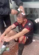 Amatör maçta kavga: 3 yaralı