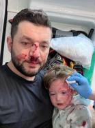 İkra ile babasının darbedilmesine ilişkin iddianame hazırlandı; çocuk skuter'ı 'silah' olarak sayıldı