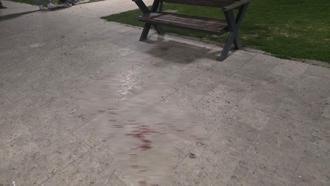 Bursa'da parkta bıçaklı kavga: 1 yaralı