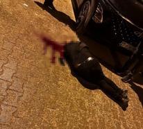 Sokakta yürürken tabanca ile başından vuruldu