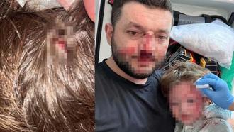 Kucağında bebeği ile darbedilen babanın oğlu, sokakta başına atılan taşla yaralandı