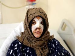 Boşanma aşamasındaki eşine vurduğu kaldırım taşı 'silah' sayıldı