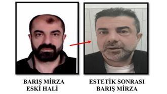 Cinayette azmettirmekten aranan şüpheli, ameliyatla yüzünü değiştirmiş