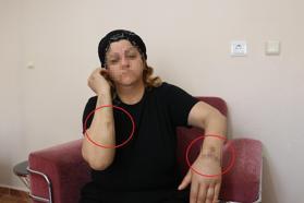 16 yıl dini nikahla birlikte yaşadığı kişi tarafından 30 yerinden bıçaklandı