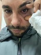 Hastaya yumruk attığı iddiasıyla doktora dava