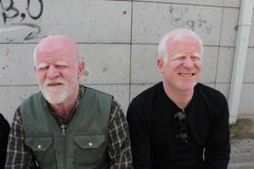 Ailesinin geçimi, babası ve kardeşi gibi kendisi de albino olan Gökhan’a emanet