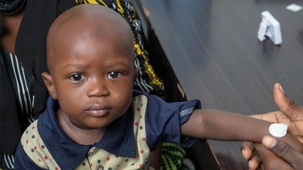 Gambia’da yürütülen mikro iğneli bant aşı testinin sonuçları başarılı