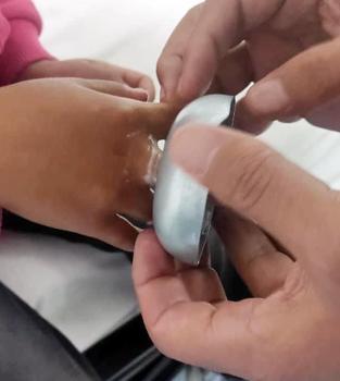 AFAD ekibi, çocuğun şeker kabı kapağına sıkışan parmağını kurtardı