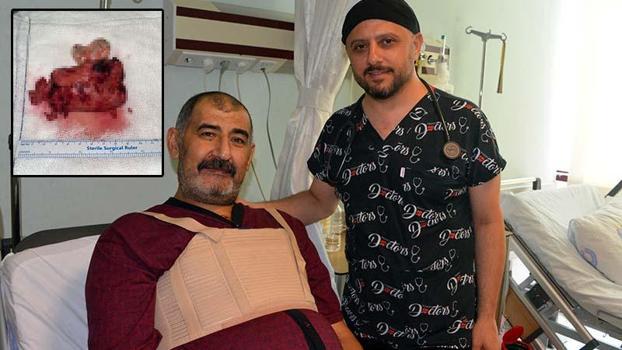 Kalbinden 10 santim büyüklüğünde kitle çıkarıldı