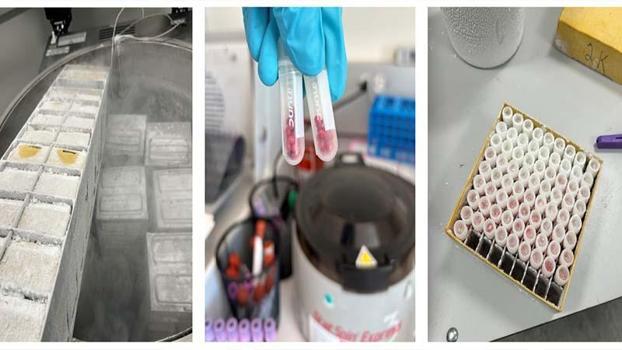 Talasemi hastalığında kan nakli güvenliğini artıran çalışma