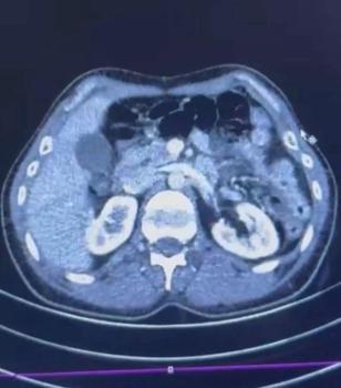 İranlı şüphelilerin midelerinde uyuşturucu tespit edildi; 3 gözaltı