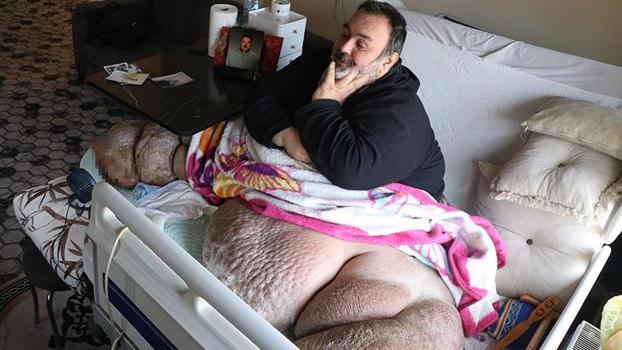 DHA'nın haberi sonrası fil hastası babaya yardım eli