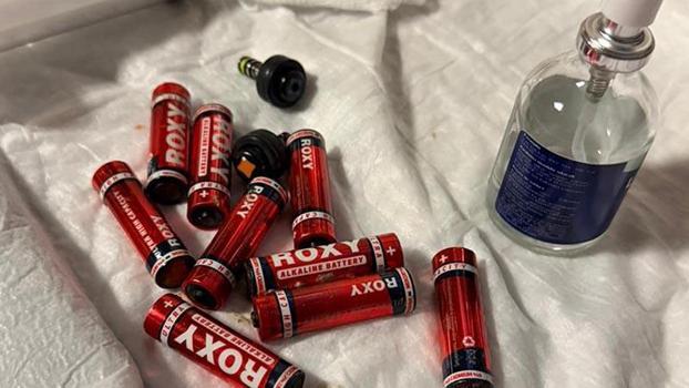 Midesindeki 9 pil, endoskopik yöntemle çıkarıldı