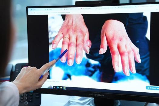 ‘Kış aylarında soğuk ısırığı vakaları artıyor’