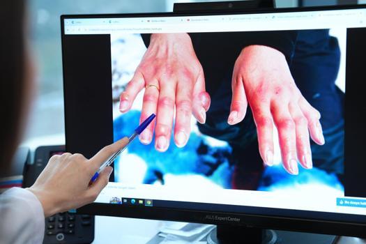 ‘Kış aylarında soğuk ısırığı vakaları artıyor’