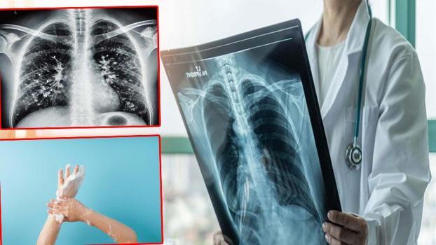 'Kışın solunum yolu enfeksiyonlarında artış doğal, hijyen şart'