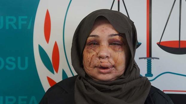 Polis eşi tarafından darbedildiği iddiasıyla şikayetçi oldu