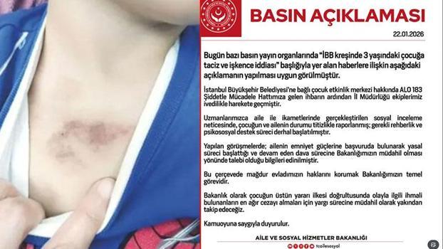 Eyüpsultan'da 3 yaşındaki çocuğa şiddet iddiası