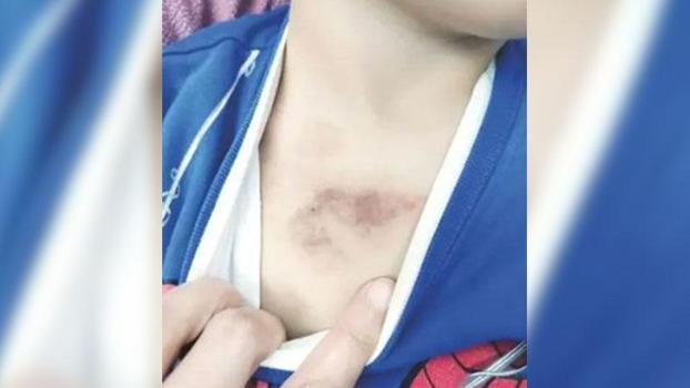 Kreşte çocuğa şiddet soruşturması; 1 şüpheli tutuklandı