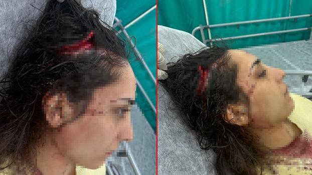 Bakkala giderken sokak köpeklerinin saldırısında yaralandı