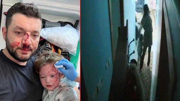 Baba ile 14 aylık bebeğinin darbedildiği olayda şüphelilerin ifadesi ortaya çıktı