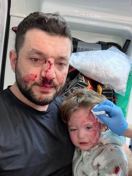 İkra ile babasının darbedilmesine ilişkin iddianame hazırlandı; çocuk skuter'ı 'silah' olarak sayıldı