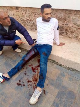 Tartıştığı butik sahibine pompalı tüfekle saldırdı: 3 yaralı