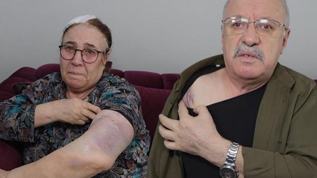 Esenyurt'ta bir yıldır tehdit ettiği çifti sopayla darbetti