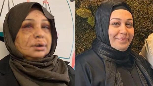 Eşini yaralayan polis memurunun dosyası, ağır cezaya gönderildi