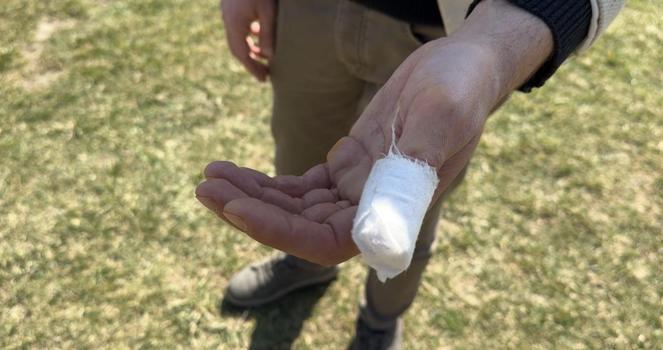 Parkta köpeği Şans ile gezerken başıboş pitbullun saldırısına uğradı