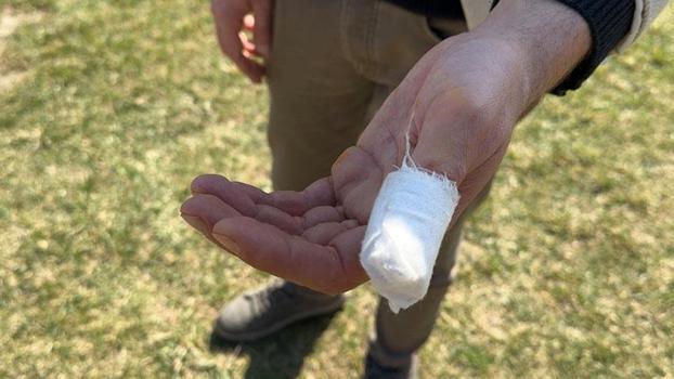 Parkta köpeği Şans ile gezerken başıboş pitbullun saldırısına uğradı