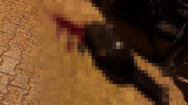 Sokakta yürürken tabanca ile başından vuruldu