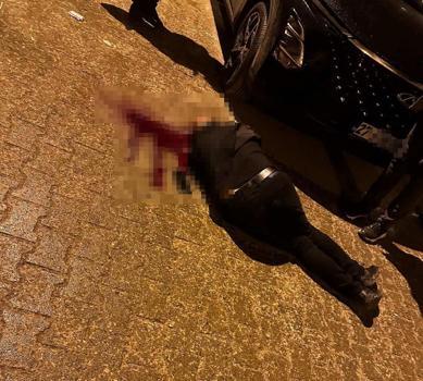 Sokakta yürürken tabanca ile başından vuruldu