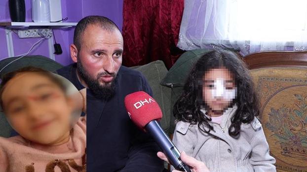 Eyupsultan'da okuldan eve dönen 6 yaşındaki çocuğa sokak köpekleri saldırdı