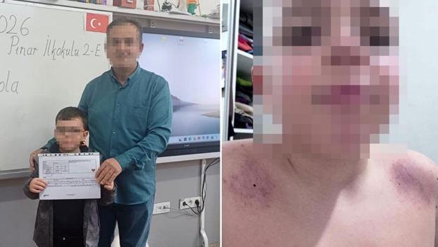 Oğlunu darbettiğini iddia ettiği öğretmenden şikayetçi oldu