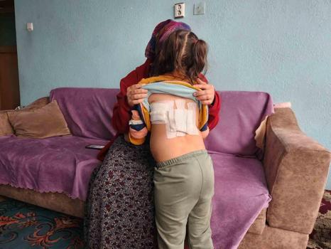 Evinin önünde oynayan çocuğa eşek saldırdı; o anlar kamerada (2)