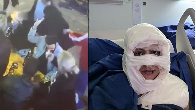 Kadıköy'de üzerine kolonya döktüğü kadını yakan sanık ilk kez hakim karşısına çıktı