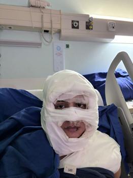 İstanbul - Kadıköy'de kolonya döktüğü kadını yakan sanık ilk kez hakim karşısına çıktı